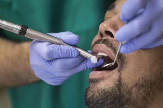 person at dentist with mouth open